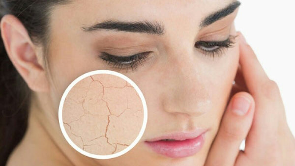What To Do About Dry Patches On Your Face - DeBelle Cosmetix Online Store